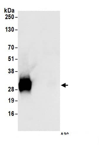 Immunoprecipitation:CTHRC1 AntibodyNBP3-29118] -Detection of human CTHRC1 by western blot of immunoprecipitates. Samples: Whole cell lysate (1.0 mg per IP reaction; 20% of IP loaded) from UACC-62 cells prepared using NETN lysis buffer. Antibodies: Affinity purified Rabbit anti-CTHRC1 antibody (NBP3-29118 lot 1) used for IP at 1 µg per reaction. CTHRC1 was not immunoprecipitated by rabbit anti-CTHRC1.. For blotting immunoprecipitated CTHRC1, was used at 0.04 mg/ml. Detection: Chemiluminescence with an exposure time time of 1 second.