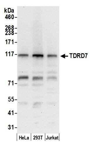 Western Blot TDRD7 Antibody