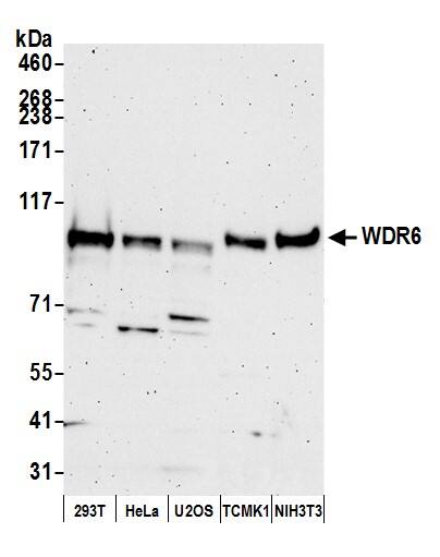 Western Blot:[NBP3-29124]-Detection of human and mouse WDR6 by western blot. Samples: Whole cell lysate from HEK293T, HeLa, U2OS, mouse TCMK-1, and mouse NIH 3T3 cells prepared using NETN lysis buffer. Antibody: Affinity purified rabbit anti-WDR6 antibody used for WB at 0. 04 mg/ml. Detection: Chemiluminescence with an exposure time of 3 minutes.