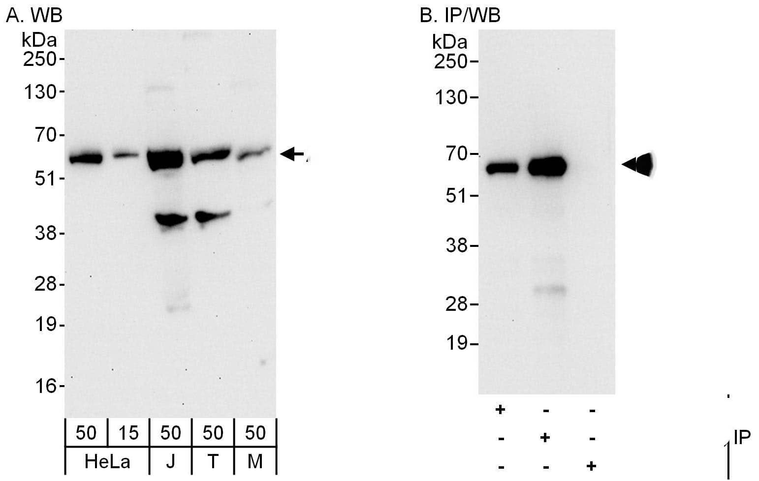 Western Blot:[NBP3-29125]-Detection of human and mouse Atlastin-3 by western blot and immunoprecipitation. Samples: Whole cell lysate from HeLa , Jurkat , HEK293T and mouse NIH 3T3 cells. Antibodies: Affinity purified rabbit anti-Atlastin-3 antibody used for WB at 0. 04 µg/ml and 1 µg/ml and used for IP at 6 µg/mg lysate. Atlastin-3 was also immunoprecipitated by rabbit anti-Atlastin-3 antibody , which recognizes an upstream epitope. Detection: Chemiluminescence with exposure times of 30 seconds and 10 seconds.