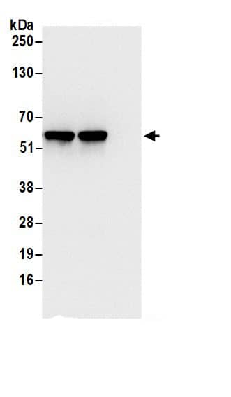 Immunoprecipitation:TCP1-eta AntibodyNBP3-29127] -Detection of human CCT7 by western blot of immunoprecipitates. Samples: Whole cell lysate (0.5 or 1.0 mg per IP reaction; 20% of IP loaded) from 293T cells prepared using NETN lysis buffer. Antibodies: Affinity purified rabbit anti-CCT7 antibody NBP3-29127 (lot NBP3-29127-1) used for IP at 6 µg per reaction. CCT7 was also immunoprecipitated by rabbit anti-CCT7.. For blotting immunoprecipitated CCT7, NBP3-29127 was used at 0.4 µg/ml. Detection: Chemiluminescence with an exposure time of 3 seconds.