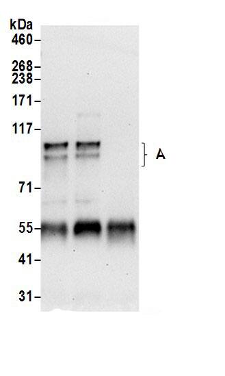 Immunoprecipitation:APBA2 AntibodyNBP3-29132] -Detection of human APBA2 by western blot of immunoprecipitates. Samples: Whole cell lysate (0.5 or 1.0 mg per IP reaction; 20% of IP loaded) from 293T cells prepared using NETN lysis buffer. Antibodies: Affinity purified rabbit anti-APBA2 antibody NBP3-29132 (lot NBP3-29132-1) used for IP at 6 µg per reaction. APBA2 was also immunoprecipitated by rabbit anti-APBA2.. For blotting immunoprecipitated APBA2, NBP3-29132 was used at 0.4 µg/ml. Detection: Chemiluminescence with an exposure time of 30 seconds.