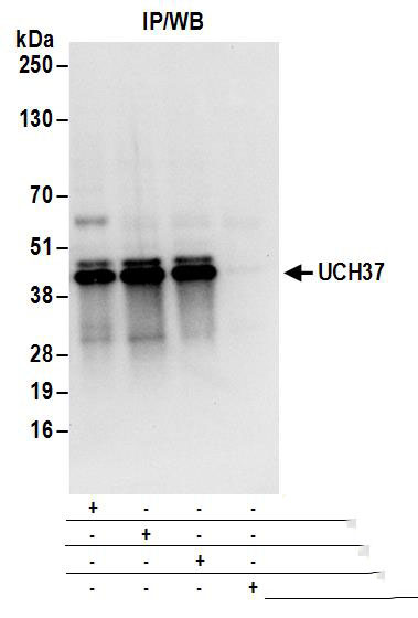 Immunoprecipitation:[NBP3-29133]-Detection of human UCH37 by western blot of immunoprecipitates. Samples: Whole cell lysate from 293T cells. Antibodies: Affinity purified rabbit anti-UCH37 antibody used for IP at 6 µg/mg lysate. UCH37 was also immunoprecipitated by rabbit anti-UCH37 antibodies and. For blotting immunoprecipitated UCH37, was used at 1 µg/ml. Detection: Chemiluminescence with an exposure time of 3 seconds.
