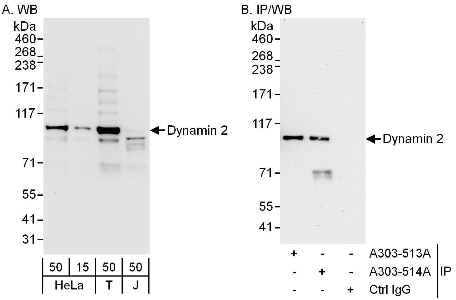 Western Blot:[NBP3-29134]-Detection of human Dynamin 2 by western blot and immunoprecipitation. Samples: Whole cell lysate from HeLa, HEK293T and Jurkat cells. Antibodies: Affinity purified rabbit anti-Dynamin 2 antibody used for WB at 0. 1 µg/ml and 1 µg/ml and used for IP at 6 µg/mg lysate. Dynamin 2 was also immunoprecipitated by rabbit anti-Dynamin 2 antibody , which recognizes an upstream epitope. Detection: Chemiluminescence with exposure times of 10 seconds and 30 seconds.