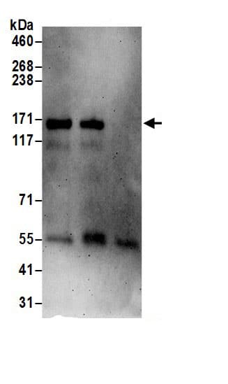 Immunoprecipitation:PTK7/CCK4 AntibodyNBP3-29135] -Detection of human PTK7 by western blot of immunoprecipitates. Samples: Whole cell lysate (1 mg for IP; 20% of IP loaded) prepared using NETN buffer from Jurkat cells. Antibodies: Affinity purified rabbit anti-PTK7 antibody NBP3-29135 (lot NBP3-29135-1) used for IP at 6 µg per reaction. PTK7 was also immunoprecipitated by rabbit anti-PTK7.. For blotting immunoprecipitated PTK7, NBP3-29135 was used at 1 µg/ml. Detection: Chemiluminescence with an exposure time of 3 minutes.