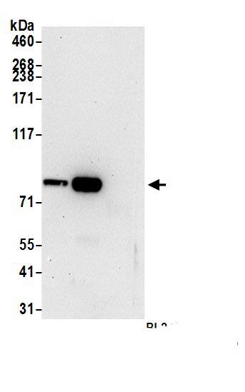 Immunoprecipitation:RASAL1 AntibodyNBP3-29136] -Detection of human RASAL1 by western blot of immunoprecipitates. Samples: Whole cell lysate (1.0 mg per IP reaction; 20% of IP loaded) from RPMI-8226 cells prepared using NETN lysis buffer. Antibodies: Affinity purified rabbit anti-RASAL1 antibody (NBP3-29136 lot 1) used for IP at 1 µg per reaction. RASAL1 was also immunoprecipitated by rabbit anti-RASAL1 antibody BL24199. For blotting immunoprecipitated RASAL1, NBP3-29136 was used at 0.04 mg/ml. Detection: Chemiluminescence with an exposure time of 30 seconds.