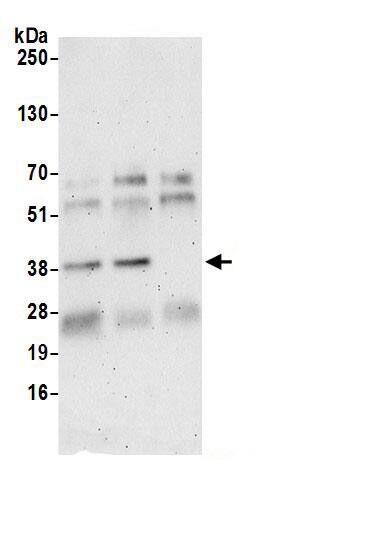 Immunoprecipitation:NIP30 AntibodyNBP3-29137] -Detection of human FAM192/NIP30 by western blot of immunoprecipitates. Samples: Whole cell lysate (0.5 or 1.0 mg per IP reaction; 20% of IP loaded) from 293T cells prepared using NETN lysis buffer. Antibodies: Affinity purified rabbit anti-FAM192/NIP30 antibody NBP3-29137 (lot NBP3-29137-1) used for IP at 6 µg per reaction. FAM192/NIP30 was also immunoprecipitated by rabbit anti-FAM192/NIP30 antibody BL19284. For blotting immunoprecipitated FAM192/NIP30, NBP3-29137 was used at 1 µg/ml. Detection: Chemiluminescence with an exposure time of 3 minutes.