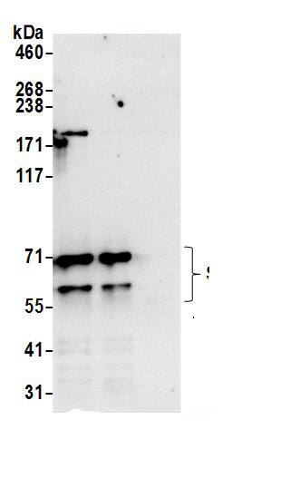 Immunoprecipitation:SRPR alpha AntibodyNBP3-29138] -Detection of human SRPRA by western blot of immunoprecipitates. Samples: Whole cell lysate (0.5 or 1.0 mg per IP reaction; 20% of IP loaded) from 293T and cells prepared using NETN lysis buffer. Antibodies: Affinity purified rabbit anti-SRPRA antibody NBP3-29138 (lot NBP3-29138-1) used for IP at 6 µg per reaction. SRPRA was also immunoprecipitated by rabbit anti-SRPRA.. For blotting immunoprecipitated SRPRA, NBP3-29138 was used at 0.4 µg/ml. Detection: Chemiluminescence with an exposure time of 10 seconds.