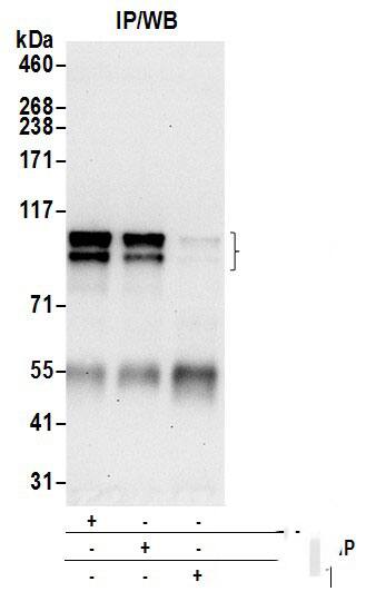 Immunoprecipitation:[NBP3-29139]-Detection of human APBA2 by western blot of immunoprecipitates. Samples: Whole cell lysate from 293T cells prepared using NETN lysis buffer. Antibodies: Affinity purified rabbit anti-APBA2 antibody used for IP at 6 µg per reaction. APBA2 was also immunoprecipitated by rabbit anti-APBA2 antibody. For blotting immunoprecipitated APBA2, was used at 0. 4 µg/ml. Detection: Chemiluminescence with an exposure time of 30 seconds.