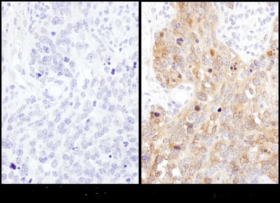 Immunohistochemistry:[NBP3-29140]-Detection of mouse ADE2 by immunohistochemistry. Samples: FFPE serial sections of mouse teratoma. Antibody: Affinity purified rabbit anti-ADE2 used at a dilution of 1: 1,000. Detection: DAB