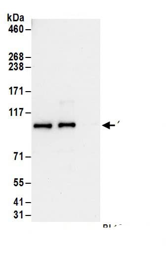 Immunoprecipitation:Gephyrin/GPHN AntibodyNBP3-29143] -Detection of human Gephyrin by western blot of immunoprecipitates. Samples: Whole cell lysate (1 mg for IP; 20% of IP loaded) from 293T cells. Antibodies: Affinity purified rabbit anti-Gephyrin antibody NBP3-29143 (lot NBP3-29143-1) used for IP at 6 µg/mg lysate. Gephyrin was also immunoprecipitated by rabbit anti-Gephyrin antibody BL15657. For blotting immunoprecipitated Gephyrin, NBP3-29143 was used at 1 µg/ml. Detection: Chemiluminescence with an exposure time of 10 seconds.