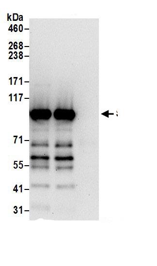 Immunoprecipitation:Striatin AntibodyNBP3-29144] -Detection of human Striatin by western blot of immunoprecipitates. Samples: Whole cell lysate (0.5 or 1.0 mg per IP reaction; 20% of IP loaded) from 293T cells prepared using NETN lysis buffer. Antibodies: Affinity purified rabbit anti-Striatin antibody NBP3-29144 (lot NBP3-29144-1) used for IP at 6 µg per reaction. Striatin was also immunoprecipitated by rabbit anti-Striatin antibody BL17187. For blotting immunoprecipitated Striatin, NBP3-29144 was used at 1 µg/ml. Detection: Chemiluminescence with an exposure time of 30 seconds.