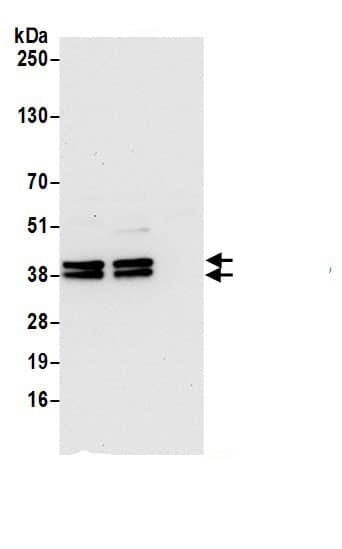 Immunoprecipitation:VTA1 AntibodyNBP3-29145] -Detection of human VTA1/LIP5 by western blot of immunoprecipitates. Samples: Whole cell lysate (0.5 or 1.0 mg per IP reaction; 20% of IP loaded) from 293T cells prepared using NETN lysis buffer. Antibodies: Affinity purified rabbit anti-VTA1/LIP5 antibody NBP3-29145 (lot NBP3-29145-1) used for IP at 6 µg per reaction. VTA1/LIP5 was also immunoprecipitated by rabbit anti-VTA1/LIP5.. For blotting immunoprecipitated VTA1/LIP5, NBP3-29145 was used at 1 µg/ml. Detection: Chemiluminescence with an exposure time of 10 seconds.