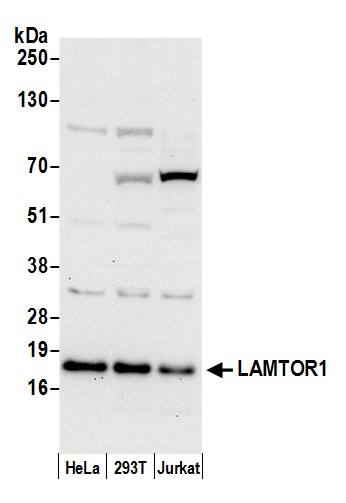 Western Blot:[NBP3-29146]-Detection of human LAMTOR1 by western blot. Samples: Whole cell lysate from HeLa, HEK293T, and Jurkat cells prepared using NETN lysis buffer. Antibody: Affinity purified rabbit anti-LAMTOR1 antibody used for WB at 0. 4 µg/ml. Detection: Chemiluminescence with an exposure time of 30 seconds.