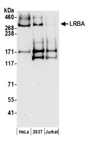 Western Blot:[NBP3-29147]-Detection of human LRBA by western blot. Samples: Whole cell lysate from HeLa, HEK293T, and Jurkat cells prepared using RIPA lysis buffer. Antibodies: Affinity purified rabbit antibody used for WB at 0. 1 µg/ml. Detection: Chemiluminescence with an exposure time of 30 seconds.