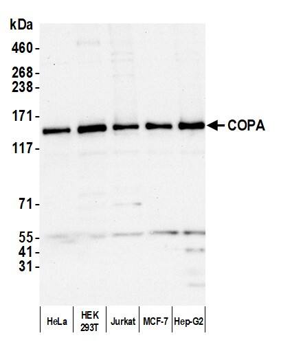 Western Blot:[NBP3-29148]-Detection of human COPA by western blot. Samples: Whole cell lysate from HeLa, HEK293T, Jurkat, MCF-7, and Hep-G2 cells prepared using NETN lysis buffer. Antibody: Affinity purified rabbit antibody used for WB at 0. 04 µg/ml. Detection: Chemiluminescence with an exposure time of 10 seconds.