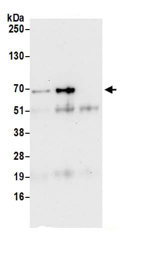 Immunoprecipitation:SPATS2 AntibodyNBP3-29150] -Detection of human SPATS2 by western blot of immunoprecipitates. Samples: Whole cell lysate (0.5 or 1.0 mg per IP reaction; 20% of IP loaded) from HeLa cells prepared using NETN lysis buffer. Antibodies: Affinity purified rabbit anti-SPATS2 antibody NBP3-29150 (lot NBP3-29150-1) used for IP at 6 µg per reaction. SPATS2 was also immunoprecipitated by rabbit anti-SPATS2.. For blotting immunoprecipitated SPATS2, NBP3-29150 was used at 0.4 µg/ml. Detection: Chemiluminescence with an exposure time of 30 seconds.