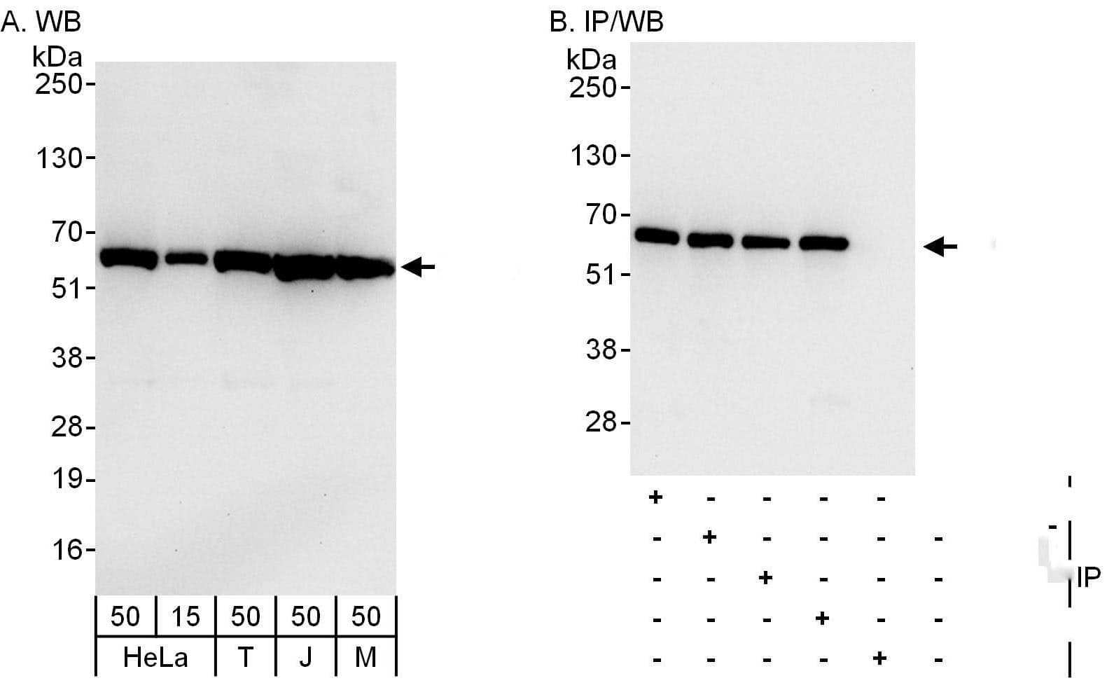 Western Blot:[NBP3-29151]-Detection of human and mouse CCT8 by western blot and immunoprecipitation. Samples: Whole cell lysate from HeLa , HEK293T , Jurkat and mouse NIH 3T3 cells. Antibodies: Affinity purified rabbit anti-CCT8 antibody used for WB at 0. 04 µg/ml and 0. 4 µg/ml and used for IP at 6 µg/mg lysate. CCT8 was also immunoprecipitated by rabbit anti-CCT8 antibodies , A303-447 and , which recognize upstream epitopes. Detection: Chemiluminescence with exposure times of 10 seconds and 3 seconds.