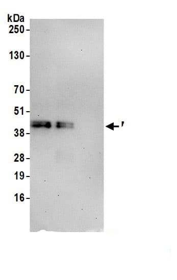 Immunoprecipitation:Mitochondrial fission regulator 1 AntibodyNBP3-29157] -Detection of human MTFR1 by western blot of immunoprecipitates. Samples: Whole cell lysate (1.0 mg per IP reaction; 20% of IP loaded) from HeLa cells prepared using NETN lysis buffer. Antibodies: Affinity purified rabbit anti-MTFR1 antibody (NBP3-29157 lot 1) used for IP at 6 µg per reaction. MTFR1 was also immunoprecipitated by rabbit anti-MTFR1.. For blotting immunoprecipitated MTFR1, NBP3-29157 was used at 0.4 mg/ml. Detection: Chemiluminescence with an exposure time of 30 seconds.