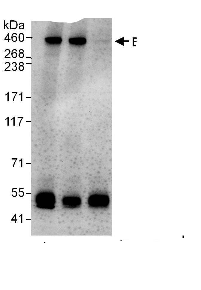 Immunoprecipitation:BRCA2 AntibodyNBP3-29158] -Detection of human BRCA2 by western blot of immunoprecipitates. Samples: Whole cell lysate (1 mg for IP, 20% of IP loaded) from HeLa cells. Antibodies: Affinity purified rabbit anti-BRCA2 antibody NBP3-29158 used for IP at 6 µg/mg lysate. BRCA2 was also immunoprecipitated by rabbit anti-BRCA2., which recognizes an upstream epitope. For blotting immunoprecipitated BRCA2, A303-434A was used at 1 µg/ml,. Detection: Chemiluminescence with an exposure time of 10 seconds.