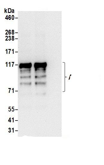 Immunoprecipitation:ARHGAP17 AntibodyNBP3-29159] -Detection of human ARHGAP17 by western blot of immunoprecipitates. Samples: Whole cell lysate (0.5 or 1.0 mg per IP reaction; 20% of IP loaded) from HeLa cells prepared using NETN lysis buffer. Antibodies: Affinity purified rabbit anti-ARHGAP17 antibody NBP3-29159 (lot NBP3-29159-1) used for IP at 6 µg per reaction. ARHGAP17 was also immunoprecipitated by rabbit anti-ARHGAP17 antibody BL18041. For blotting immunoprecipitated ARHGAP17, NBP3-29159 was used at 0.4 µg/ml. Detection: Chemiluminescence with an exposure time of 10 seconds.