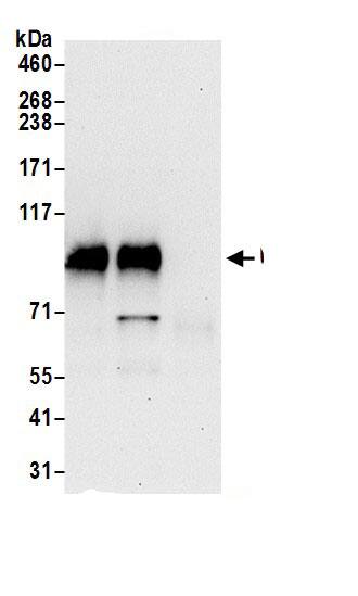 Immunoprecipitation:UNK AntibodyNBP3-29161] -Detection of human UNK by western blot of immunoprecipitates. Samples: Whole cell lysate (0.5 or 1.0 mg per IP reaction; 20% of IP loaded) from 293T cells prepared using NETN lysis buffer. Antibodies: Affinity purified rabbit anti-UNK antibody NBP3-29161 (lot NBP3-29161-1) used for IP at 6 µg per reaction. UNK was also immunoprecipitated by rabbit anti-UNK antibody for blotting immunoprecipitated UNK, NBP3-29161 was used at 0.4 µg/ml. Detection: Chemiluminescence with an exposure time of 30 seconds.