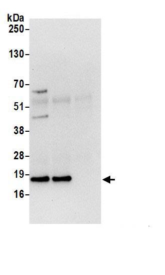 Immunoprecipitation:ARF6 AntibodyNBP3-29163] -Detection of human ARF6 by western blot of immunoprecipitates. Samples: Whole cell lysate (0.5 or 1.0 mg per IP reaction; 20% of IP loaded) from 293T cells prepared using NETN lysis buffer. Antibodies: Affinity purified rabbit anti-ARF6 antibody NBP3-29163 (lot NBP3-29163-1) used for IP at 6 µg per reaction. ARF6 was also immunoprecipitated by rabbit anti-ARF6.. For blotting immunoprecipitated ARF6, NBP3-29163 was used at 1 µg/ml. Detection: Chemiluminescence with an exposure time of 10 seconds.