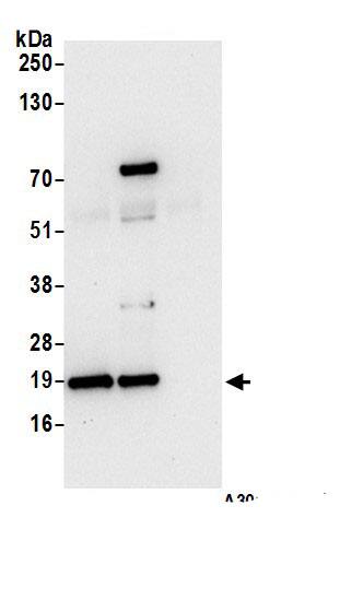 Immunoprecipitation:ARF6 AntibodyNBP3-29164] -Detection of human ARF6 by western blot of immunoprecipitates. Samples: Whole cell lysate (0.5 or 1.0 mg per IP reaction; 20% of IP loaded) from 293T cells prepared using NETN lysis buffer. Antibodies: Affinity purified rabbit anti-ARF6 antibody NBP3-29164 (lot NBP3-29164-1) used for IP at 6 µg per reaction. ARF6 was also immunoprecipitated by rabbit anti-ARF6.. For blotting immunoprecipitated ARF6, NBP3-29164 was used at 1 µg/ml. Detection: Chemiluminescence with an exposure time of 10 seconds.