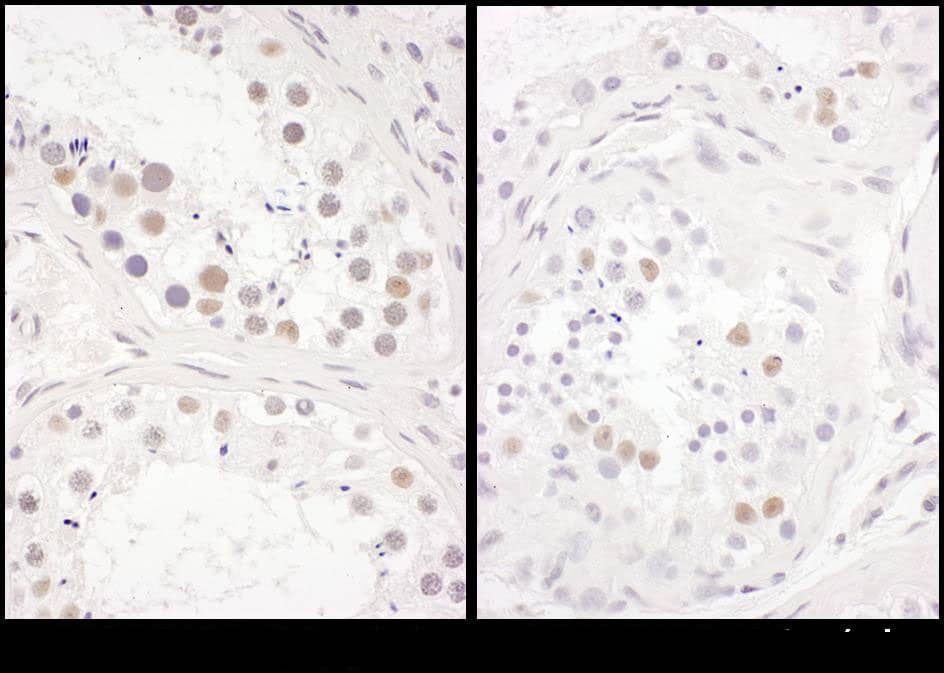 Immunohistochemistry:[NBP3-29165]-Detection of human DENTT by immunohistochemistry. Samples: FFPE serial sections of human testis. Antibody: Affinity purified rabbit anti-DENTT used at a dilution of 1: 1,000. Detection: DAB