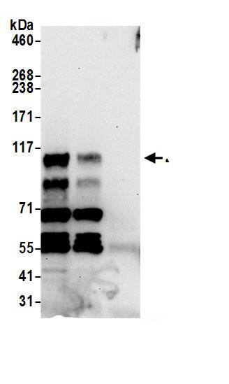 Immunoprecipitation:ZC3H7B AntibodyNBP3-29169] -Detection of human ZC3H7B by western blot of immunoprecipitates. Samples: Whole cell lysate (0.5 or 1.0 mg per IP reaction; 20% of IP loaded) from HeLa cells prepared using NETN lysis buffer. Antibodies: Affinity purified rabbit anti-ZC3H7B antibody NBP3-29169 (lot NBP3-29169-1) used for IP at 6 µg per reaction. ZC3H7B was also immunoprecipitated by rabbit anti-ZC3H7B.. For blotting immunoprecipitated ZC3H7B, NBP3-29169 was used at 0.4 µg/ml. Detection: Chemiluminescence with an exposure time of 30 seconds.