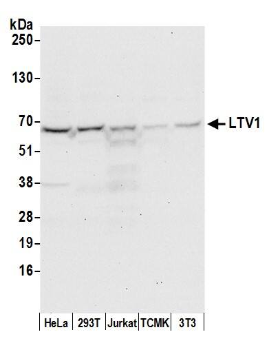 Western Blot:[NBP3-29172]-Detection of human and mouse LTV1 by western blot. Samples: Whole cell lysate from HeLa, HEK293T, Jurkat, mouse TCMK-1, and mouse NIH 3T3 cells prepared using NETN lysis buffer. Antibody: Affinity purified rabbit anti-LTV1 antibody used for WB at 0. 1 µg/ml. Detection: Chemiluminescence with an exposure time of 30 seconds.