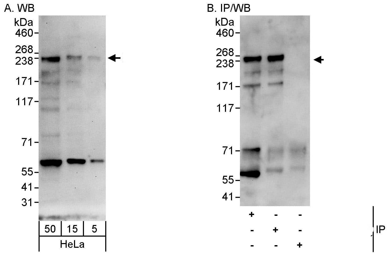Western Blot:[NBP3-29176]-Detection of human CEP152 by western blot and immunoprecipitation. Samples: Whole cell lysate from HeLa cells. Antibodies: Affinity purified rabbit anti-CEP152 antibody used for WB at 0. 1 µg/ml and 1 µg/ml and used for IP at 10 µg/mg lysate. CEP152 was also immunoprecipitated by rabbit anti-CEP152 antibody , which recognizes a downstream epitope. Detection: Chemiluminescence with exposure times of 30 seconds and 10 seconds.