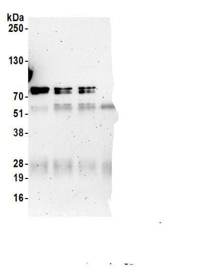 Immunoprecipitation:p66 alpha AntibodyNBP3-29179] -Detection of human p66alpha by western blot of immunoprecipitates. Samples: Whole cell lysate (1.0 mg per IP reaction; 20% of IP loaded) from HEK293T cells prepared using NETN lysis buffer. Antibodies: Affinity purified rabbit anti-p66alpha antibody (NBP3-29179 lot 3) used for IP at 6 µg per reaction. p66alpha was also immunoprecipitated by a previous lot of this antibody (NBP3-29179 lot 2) and a second.inst a different epitope of p66alpha (A302-357A). For blotting immunoprecipitated p66alpha, NBP3-29179 was used at 0.1 µg/ml. Detection: Chemiluminescence with an exposure time of 3 minutes.