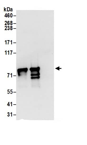 Immunoprecipitation:DYNC1I2 AntibodyNBP3-29180] -Detection of human DYNC1I2 by western blot of immunoprecipitates. Samples: Whole cell lysate (0.5 or 1.0 mg per IP reaction; 20% of IP loaded) from 293T cells prepared using NETN lysis buffer. Antibodies: Affinity purified rabbit anti-DYNC1I2 antibody NBP3-29180 (lot NBP3-29180-1) used for IP at 6 µg per reaction. DYNC1I2 was also immunoprecipitated by rabbit anti-DYNC1I2.. For blotting immunoprecipitated DYNC1I2, NBP3-29180 was used at 1 µg/ml. Detection: Chemiluminescence with an exposure time of 3 seconds.