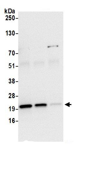 Immunoprecipitation:MT-CO2 AntibodyNBP3-29185] -Detection of human MT-CO2 by western blot of immunoprecipitates. Samples: Whole cell lysate (0.5 or 1.0 mg per IP reaction; 20% of IP loaded) from Hep-G2cells prepared using NETN lysis buffer. Antibodies: Affinity purified rabbit anti-MT-CO2 antibody NBP3-29185 (lot NBP3-29185-1) used for IP at 6 µg per reaction. MT-CO2 was also immunoprecipitated by rabbit anti-MT-CO2.. For blotting immunoprecipitated MT-CO2, NBP3-29185 was used at 1 µg/ml. Detection: Chemiluminescence with an exposure time of 10 seconds.