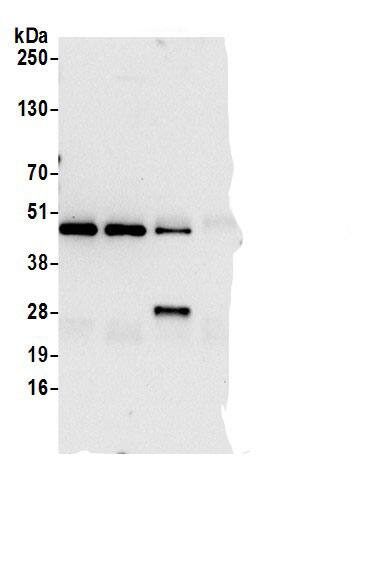 Immunoprecipitation:Perilipin-3/TIP47 AntibodyNBP3-29186] -Detection of human PLIN3 by western blot of immunoprecipitates. Samples: Whole cell lysate (0.5 or 1.0 mg per IP reaction; 20% of IP loaded) from 293T cells prepared using NETN lysis buffer. Antibodies: Affinity purified rabbit anti-PLIN3 antibody NBP3-29186 (lot NBP3-29186-1) used for IP at 6 µg per reaction. PLIN3 was also immunoprecipitated by rabbit anti-PLIN3 antibodies A305-337A and BL31148. For blotting immunoprecipitated PLIN3, NBP3-29186 was used at 1 µg/ml. Detection: Chemiluminescence with an exposure time of 10 seconds.