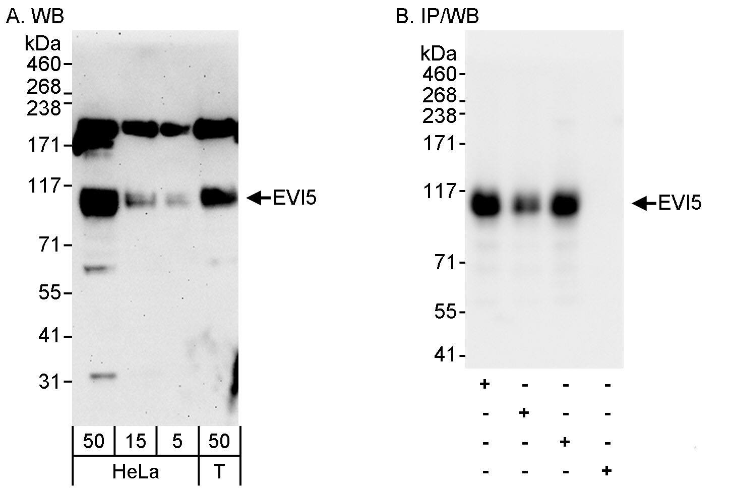 Western Blot:[NBP3-29187]-Detection of human EVI5 by western blot and immunoprecipitation. Samples: Whole cell lysate from HeLa and HEK293T cells. Antibodies: Affinity purified rabbit anti-EVI5 antibody BL3342 used for WB at 0. 04 µg/ml and 1 µg/ml and used for IP at 3 µg/mg lysate. EVI5 was also immunoprecipitated by rabbit anti-EVI5 antibodies BL3340 and BL3341, which recognize upstream epitopes. Detection: Chemiluminescence with exposure times of 3 minutes and 1 second.