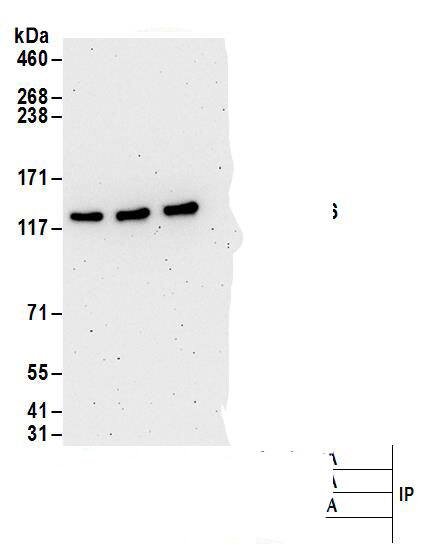 Immunoprecipitation:FLJ10808 AntibodyNBP3-29188] -Detection of human UBA6 by western blot of immunoprecipitates. Samples: Whole cell lysate (1 mg for IP; 20% of IP loaded) from 293T cells. Antibodies: Affinity purified rabbit anti-UBA6 antibody NBP3-29188 (lot NBP3-29188-1) used for IP at 6 µg/mg lysate. UBA6 was also immunoprecipitated by rabbit anti-UBA6 antibodies. For blotting immunoprecipitated UBA6, NBP3-29188 was used at 0.1 µg/ml. Detection: Chemiluminescence with an exposure time of 3 minutes.