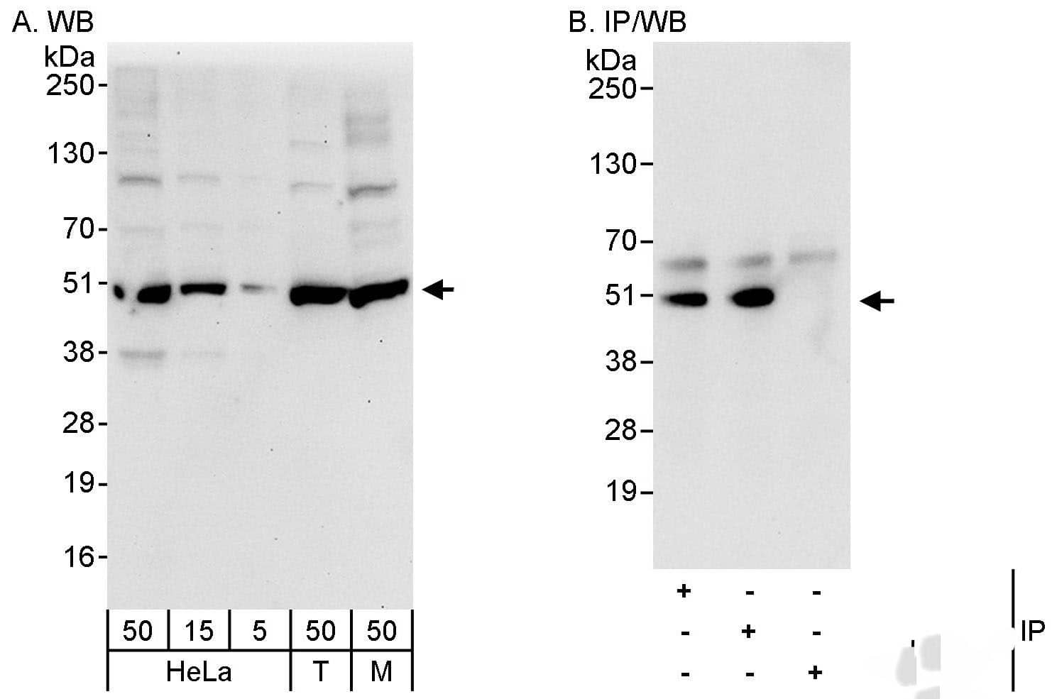 Western Blot:[NBP3-29192]-Detection of human and mouse CDC37 by western blot and immunoprecipitation. Samples: Whole cell lysate from HeLa , HEK293T , and mouse NIH 3T3 cells. Antibodies: Affinity purified rabbit anti-CDC37 antibody used for WB at 0. 4 µg/ml and 1 µg/ml and used for IP at 3 µg/mg lysate. CDC37 was also immunoprecipitated by rabbit anti-CDC37 antibody , which recognizes a downstream epitope. Detection: Chemiluminescence with exposure times of 30 seconds and 10 seconds.