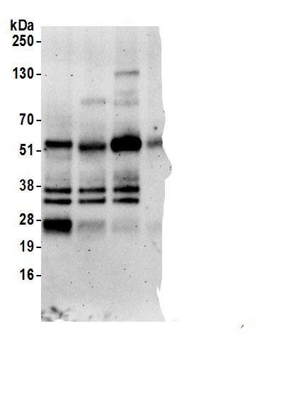Immunoprecipitation:Stanniocalcin 2/STC-2 AntibodyNBP3-29193] -Detection of human Stanniocalcin 2 by western blot of immunoprecipitates. Samples: Whole cell lysate (0.5 or 1.0 mg per IP reaction; 20% of IP loaded) from HeLa cells prepared using NETN lysis buffer. Antibodies: Affinity purified rabbit anti-Stanniocalcin 2 antibody NBP3-29193 (lot NBP3-29193-2) used for IP at 6 µg per reaction. Stanniocalcin 2 was also immunoprecipitated by a previous lot of this antibody (lot NBP3-29193-1) and rabbit anti-Stanniocalcin 2 antibody BL5498 For blotting immunoprecipitated Stanniocalcin 2, NBP3-29193 was used at 0.4 µg/ml. Detection: Chemiluminescence with an exposure time of 3 minutes.