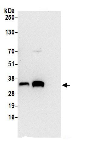 Immunoprecipitation:SRM AntibodyNBP3-29194] -Detection of human SRM by western blot of immunoprecipitates. Samples: Whole cell lysate (0.5 or 1.0 mg per IP reaction; 20% of IP loaded) from 293T cells prepared using NETN lysis buffer. Antibodies: Affinity purified rabbit anti-SRM antibody NBP3-29194 (lot NBP3-29194-1) used for IP at 6 µg per reaction. SRM was also immunoprecipitated by rabbit anti-SRM.. For blotting immunoprecipitated SRM, NBP3-29194 was used at 0.4 µg/ml. Detection: Chemiluminescence with an exposure time of 30 seconds.