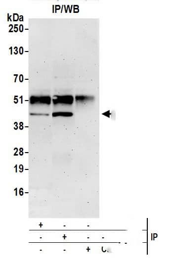 Immunoprecipitation:[NBP3-29195]-Detection of human EBNA1BP2 by western blot of immunoprecipitates. Samples: Whole cell lysate from HeLa cells prepared using NETN lysis buffer. Antibodies: Affinity purified rabbit anti-EBNA1BP2 antibody used for IP at 6 µg per reaction. EBNA1BP2 was also immunoprecipitated by rabbit anti-EBNA1BP2 antibody. For blotting immunoprecipitated EBNA1BP2, was used at 1 µg/ml. Detection: Chemiluminescence with an exposure time of 3 minutes.