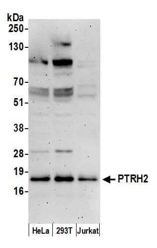 Western Blot:[NBP3-29199]-Detection of human PTRH2 by western blot. Samples: Whole cell lysate from HeLa, HEK293T, and Jurkat cells prepared using NETN lysis buffer. Antibody: Affinity purified rabbit anti-PTRH2 antibody used for WB at 0. 1 µg/ml. Detection: Chemiluminescence with an exposure time of 3 minutes.