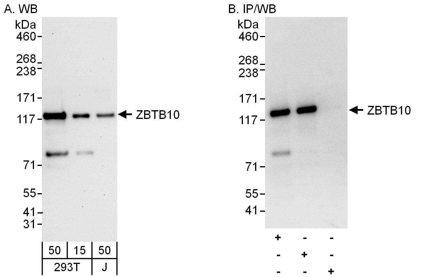 Western Blot ZBTB10 Antibody - BSA Free