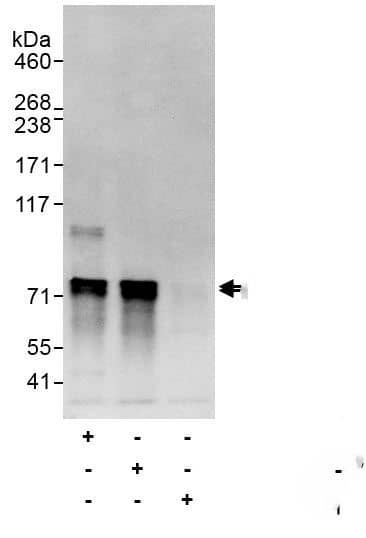 Immunoprecipitation:[NBP3-29201]-Detection of human Atg16L1 by western blot of immunoprecipitates. Samples: Whole cell lysate from HeLa cells prepared using NETN lysis buffer. Antibodies: Affinity purified rabbit anti-Atg16L1 antibody used for IP at 6 µg/mg lysate. Atg16L1 was also immunoprecipitated by rabbit anti-Atg16L1 antibody. For blotting immunoprecipitated Atg16L1, was used at 1 µg/ml. Detection: Chemiluminescence with exposure time of 3 seconds.