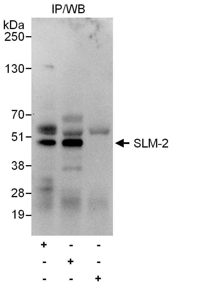 Immunoprecipitation:[NBP3-29205]-Detection of human SLM-2 by western blot of immunoprecipitates. Samples: Whole cell lysate from HeLa cells. Antibodies: Affinity purified rabbit anti-SLM-2 antibody used for IP at 6 µg/mg lysate. SLM-2 was also immunoprecipitated by rabbit anti-SLM-2 antibody , which recognizes a downstream epitope. For blotting immunoprecipitated SLM-2, was used at 1 µg/ml. Detection: Chemiluminescence with an exposure time of 30 seconds.