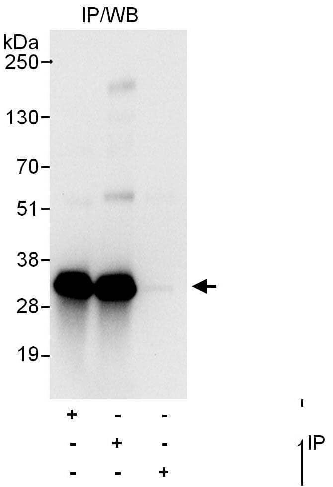 Immunoprecipitation:[NBP3-29206]-Detection of human CIP29 by western blot of immunoprecipitates. Samples: Whole cell lysate from HeLa cells. Antibodies: Affinity purified rabbit anti-CIP29 antibody used for IP at 6 µg/mg lysate. CIP29 was also immunoprecipitated by rabbit anti-CIP29 antibody , which recognizes a downstream epitope. For blotting immunoprecipitated CIP29, was used at 0. 4 µg/ml. Detection: Chemiluminescence with an exposure time of 10 seconds.