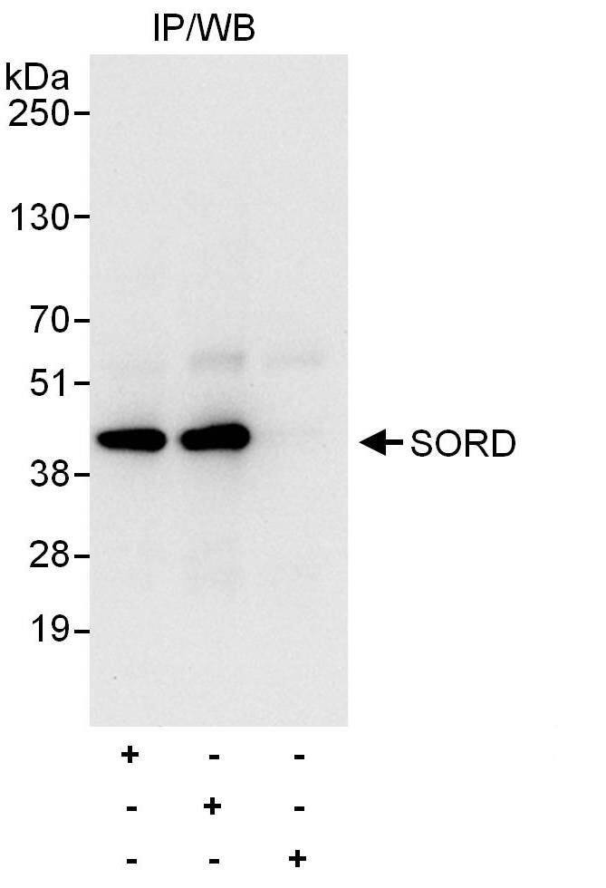 Immunoprecipitation:[NBP3-29207]-Detection of human SORD by western blot of immunoprecipitates. Samples: Whole cell lysate from HeLa cells. Antibodies: Affinity purified rabbit anti-SORD antibody used for IP at 6 µg/mg lysate. SORD was also immunoprecipitated by rabbit anti-SORD antibody , which recognizes a downstream epitope. For blotting immunoprecipitated SORD, was used at 0. 4 µg/ml,. Detection: Chemiluminescence with an exposure time of 10 seconds.