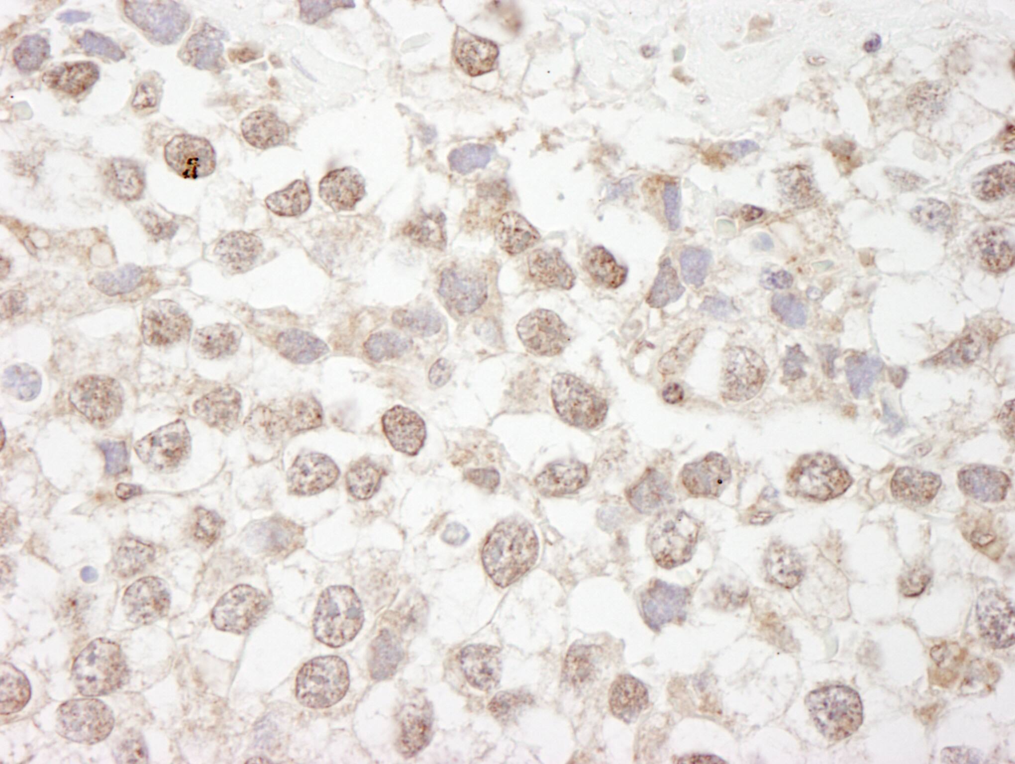 Immunohistochemistry:[NBP3-29208]-Detection of human MBD4 by immunohistochemistry. Sample: FFPE section of human testicular seminoma. Antibody: Affinity purified rabbit anti-MBD4.
