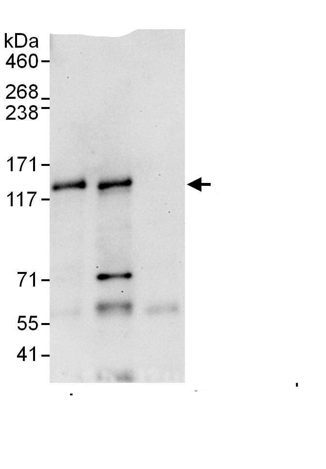 Immunoprecipitation:SNM1 AntibodyNBP3-29212] -Detection of human SNM1A by western blot of immunoprecipitates. Samples: Whole cell lysate (1 mg for IP, 20% of IP loaded) from HEK293T cells. Antibodies: Affinity purified rabbit anti-SNM1A antibody NBP3-29212 used for IP at 6 µg/mg lysate. SNM1A was also immunoprecipitated by rabbit anti-SNM1A., which recognizes a downstream epitope. For blotting immunoprecipitated SNM1A, was used at 1 µg/ml. Detection: Chemiluminescence with an exposure time of 30 seconds.